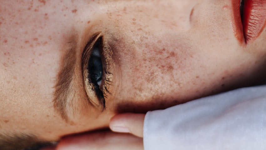 Freckles style: Οι τρόποι για να αποκτήσεις φακίδες όταν δεν τις έχεις από φυσικού σου